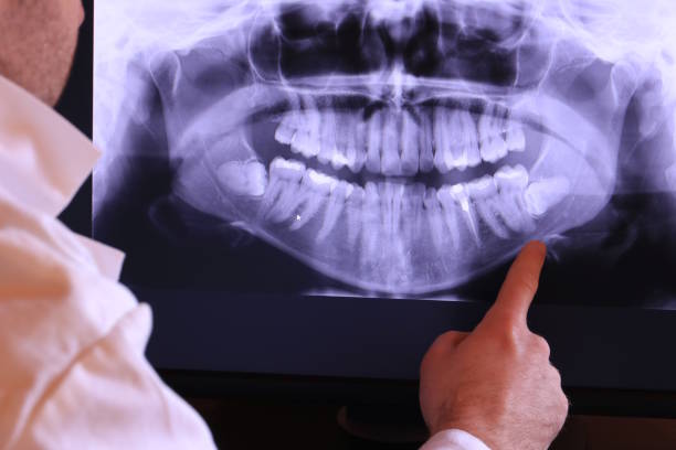 Best Walk-In Emergency Dental Services in Princeton Meadows, NJ