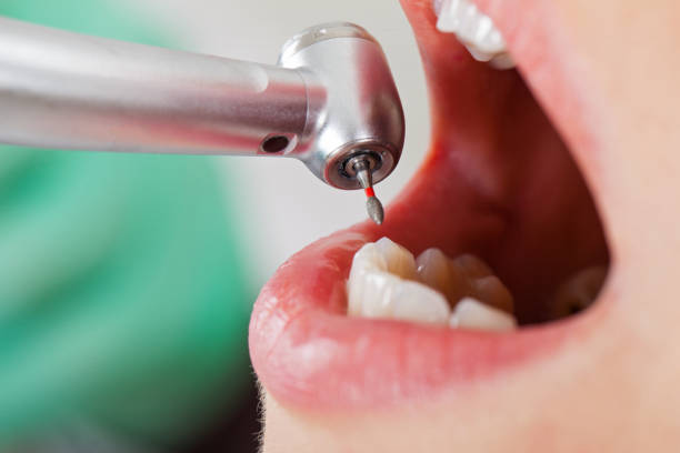 Best Dental Abscess Treatment in Princeton Meadows, NJ